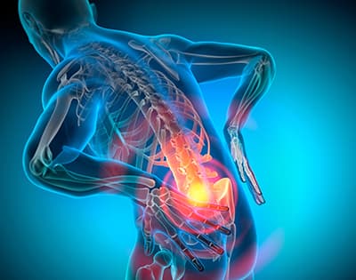 Long-Term Recovery and Lifestyle Adjustments